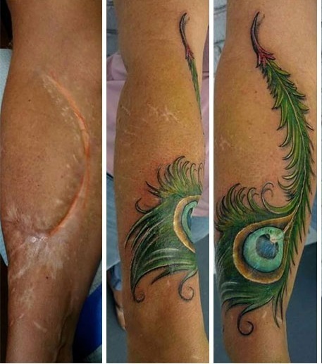 Narben Tattoos Tatowierungen Konnen Narben Geschickt Kaschieren